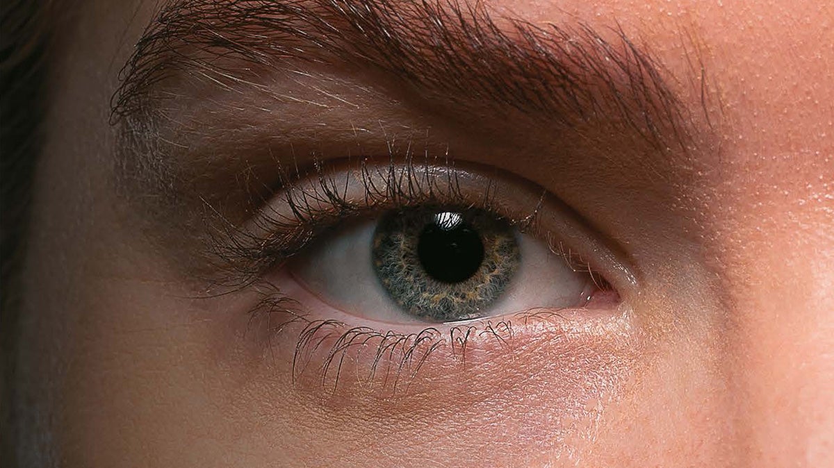 Øye med kontaktlinse